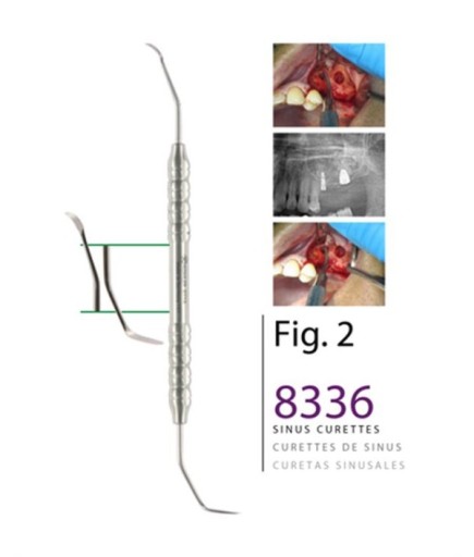 Kohler  Sinüs Lifting Aleti - 8336
